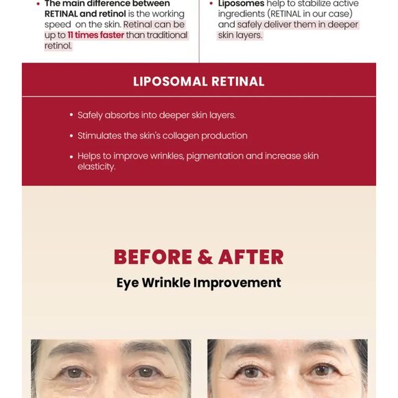 KSECRET, SEOUL 1988 Eye Cream: Retinal Liposome 4% + Fermented Bean - Picture 5 of 14